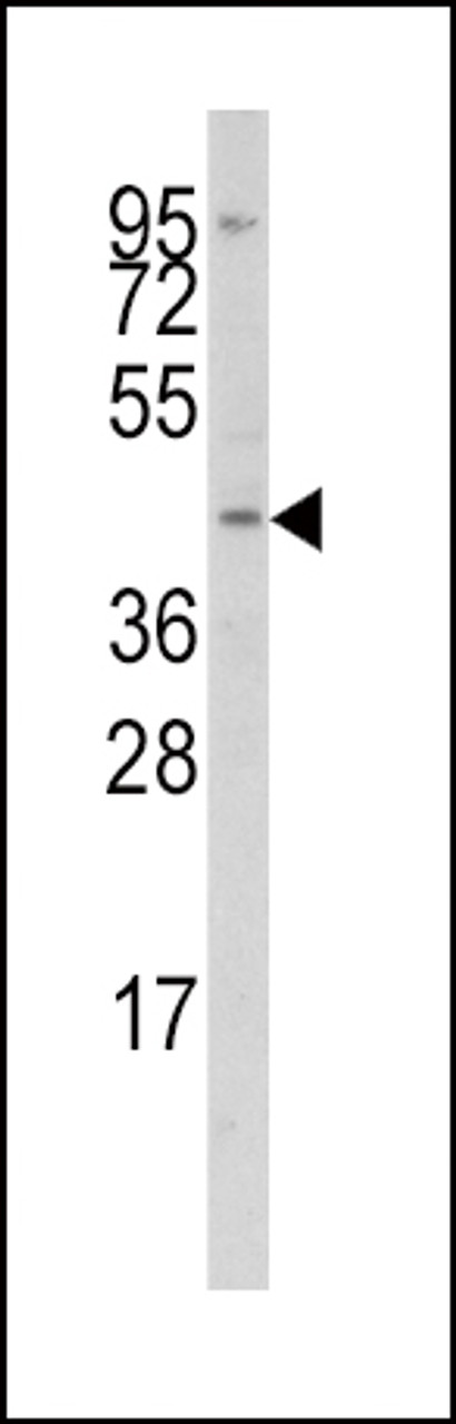 Western blot analysis of anti-IRF8 Antibody in Jurkat cell line lysates (35ug/lane)
