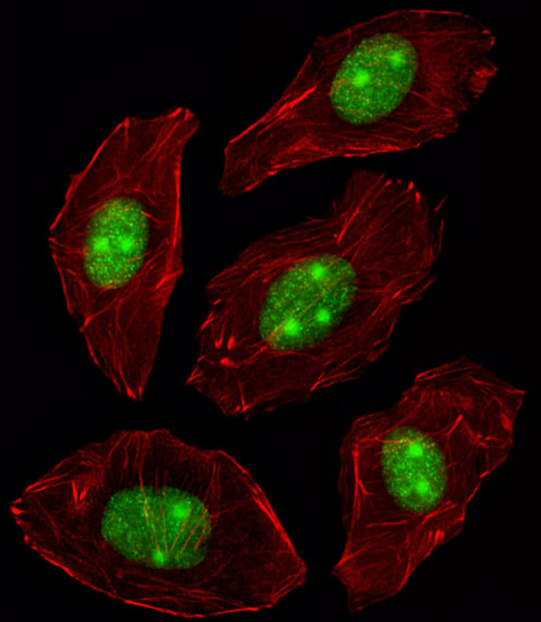 Fluorescent image of A549 cell stained with NPM1 Antibody . A549 cells were fixed with 4% PFA (20 min) , permeabilized with Triton X-100 (0.1%, 10 min) , then incubated with NPM1 primary antibody (1:25) . For secondary antibody, Alexa Fluor 488 conjugated donkey anti-rabbit antibody (green) was used (1:400) .Cytoplasmic actin was counterstained with Alexa Fluor 555 (red) conjugated Phalloidin (7units/ml) .NPM1 immunoreactivity is localized to Nucleus and Nucleolus significantly.