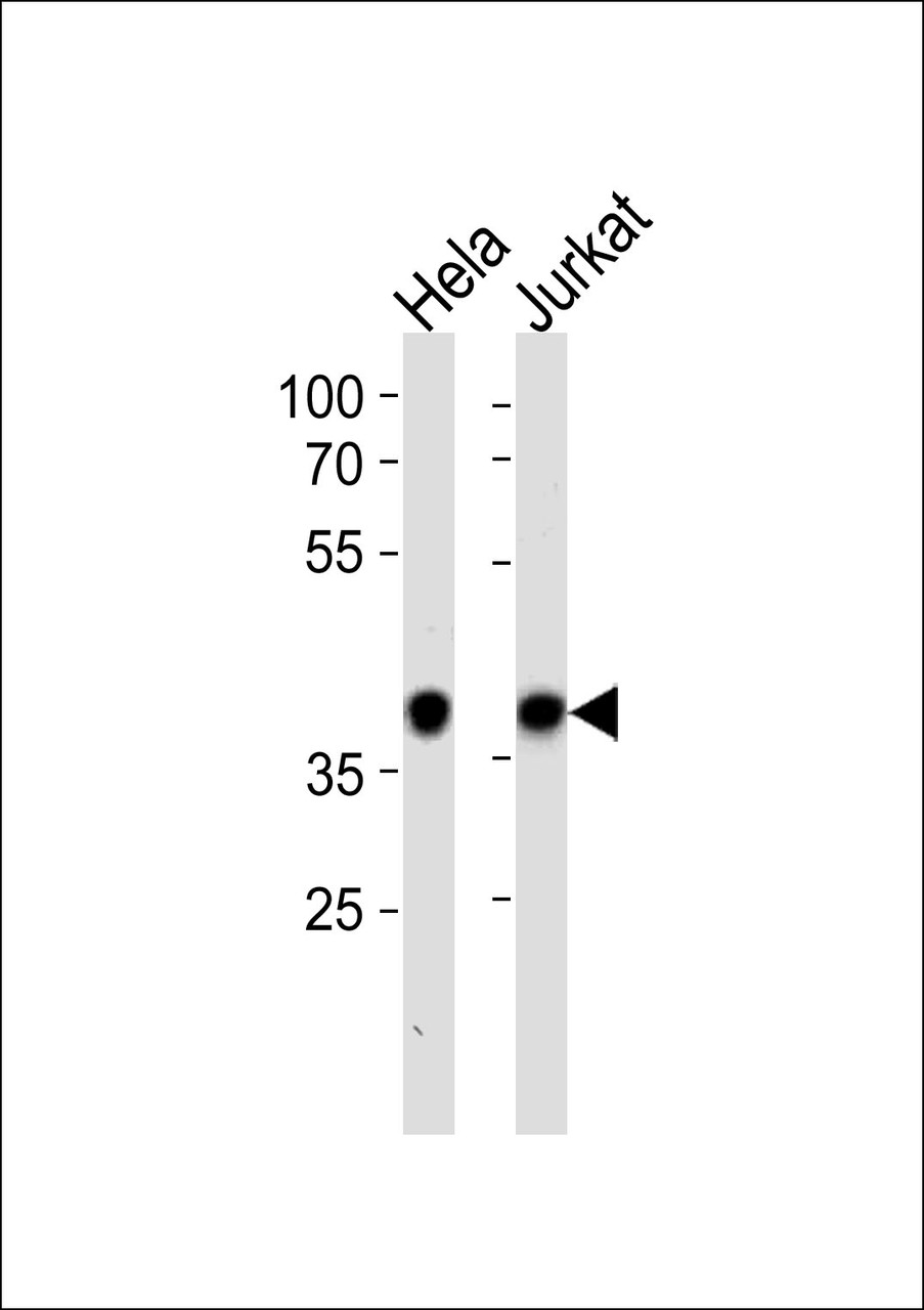 Western blot analysis in Hela, Jurkat cell line lysates (35ug/lane) .