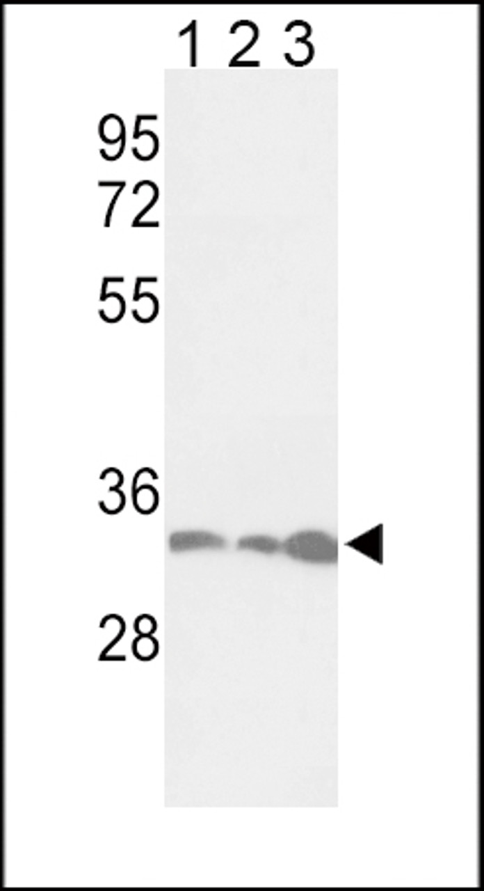 Western blot analysis of PCNA Antibody in Jurkat (lane 1) , Hela (lane 2) , 293 (lane 3) cell line lysates (35ug/lane)