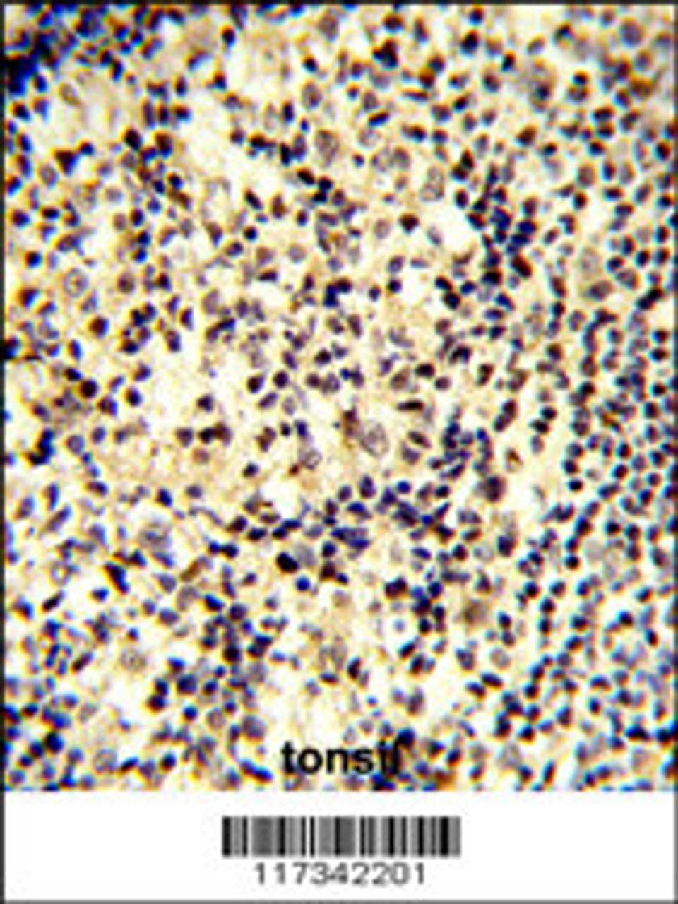 Formalin-fixed and paraffin-embedded human tonsil tissue reacted with SNRPD1 Antibody, which was peroxidase-conjugated to the secondary antibody, followed by DAB staining.