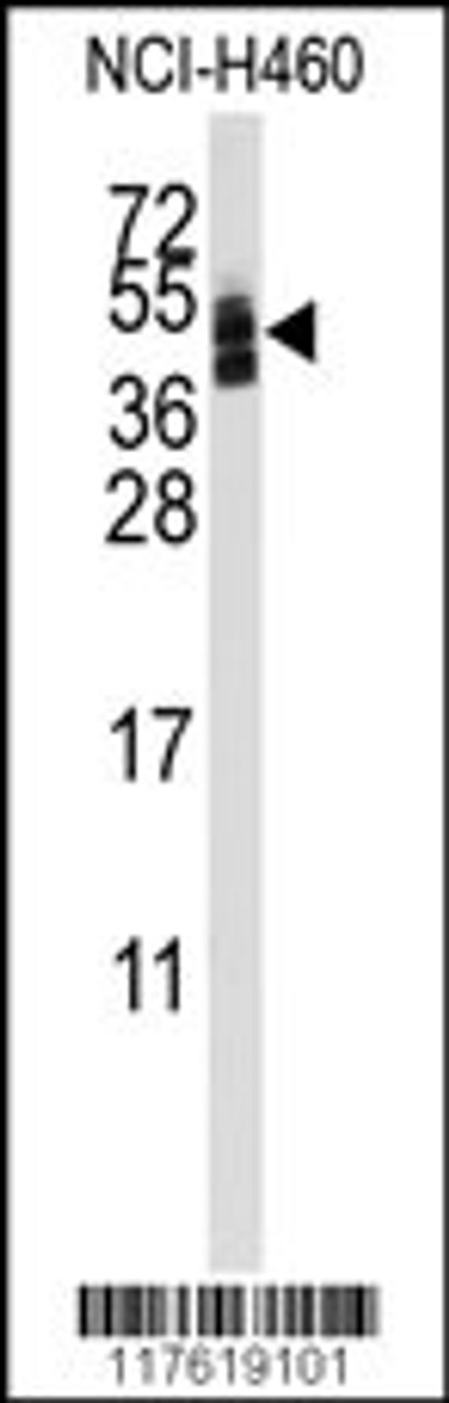 Western blot analysis of anti-CXADR Antibody in NCI-H460 cell line lysates (35ug/lane) .