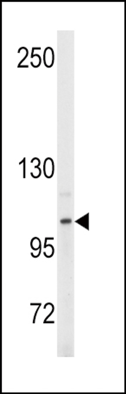 Western blot analysis of anti- in Y79 cell line lysates (35ug/lane) .