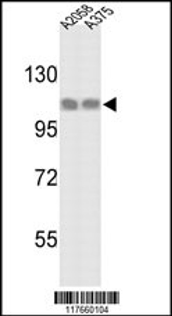 Western blot analysis of HSPH1 Antibody in A2058 and A375 cell line lysates (35ug/lane)