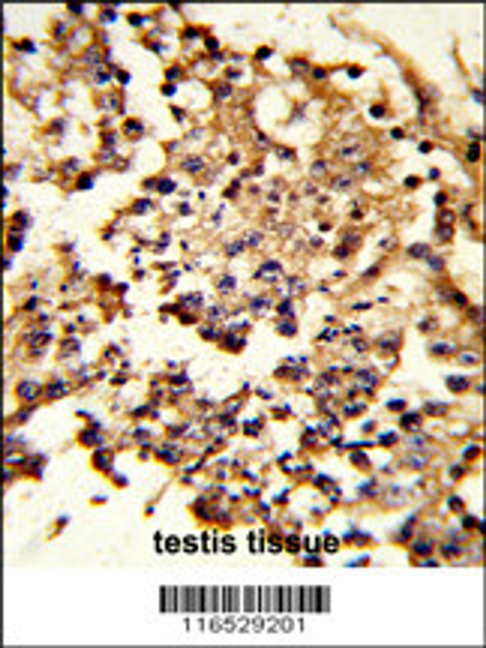 Formalin-fixed and paraffin-embedded human testis tissue reacted with HSPH1 Antibody, which was peroxidase-conjugated to the secondary antibody, followed by DAB staining.