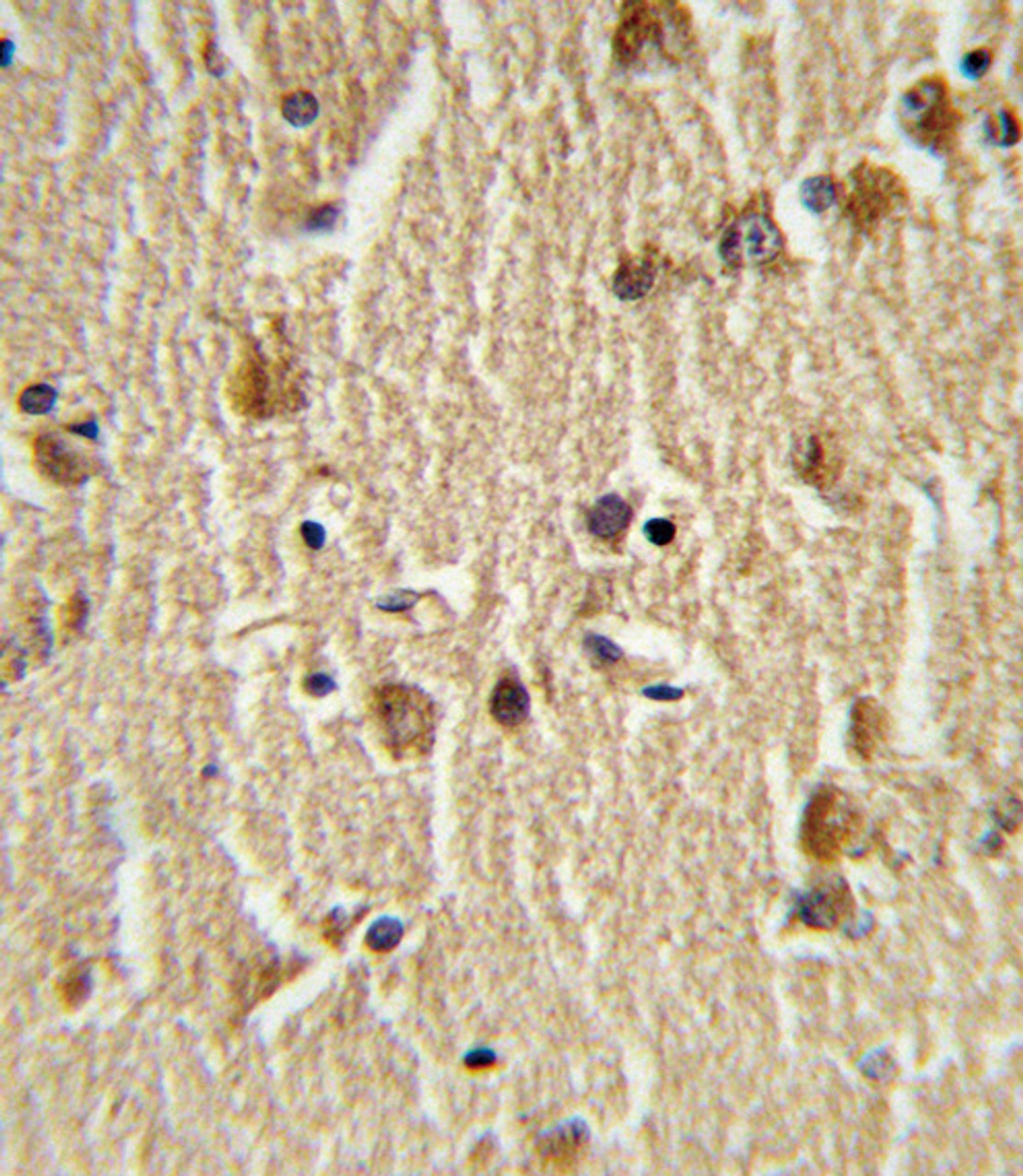 Formalin-fixed and paraffin-embedded human brain tissue reacted with HSPA8 Antibody (N-term) , which was peroxidase-conjugated to the secondary antibody, followed by DAB staining.