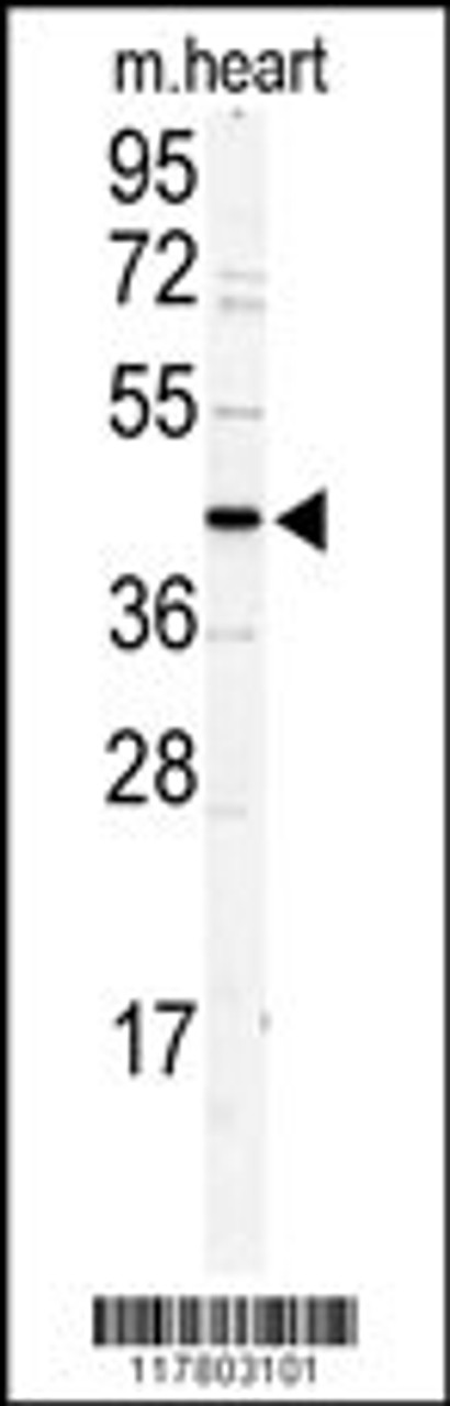 Western blot analysis of DCC1 antibody in mouse heart tissue lysates (35ug/lane)