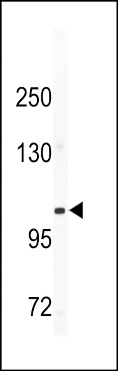 Western blot analysis of CD49e antibody in mouse bladder tissue lysates (35ug/lane)