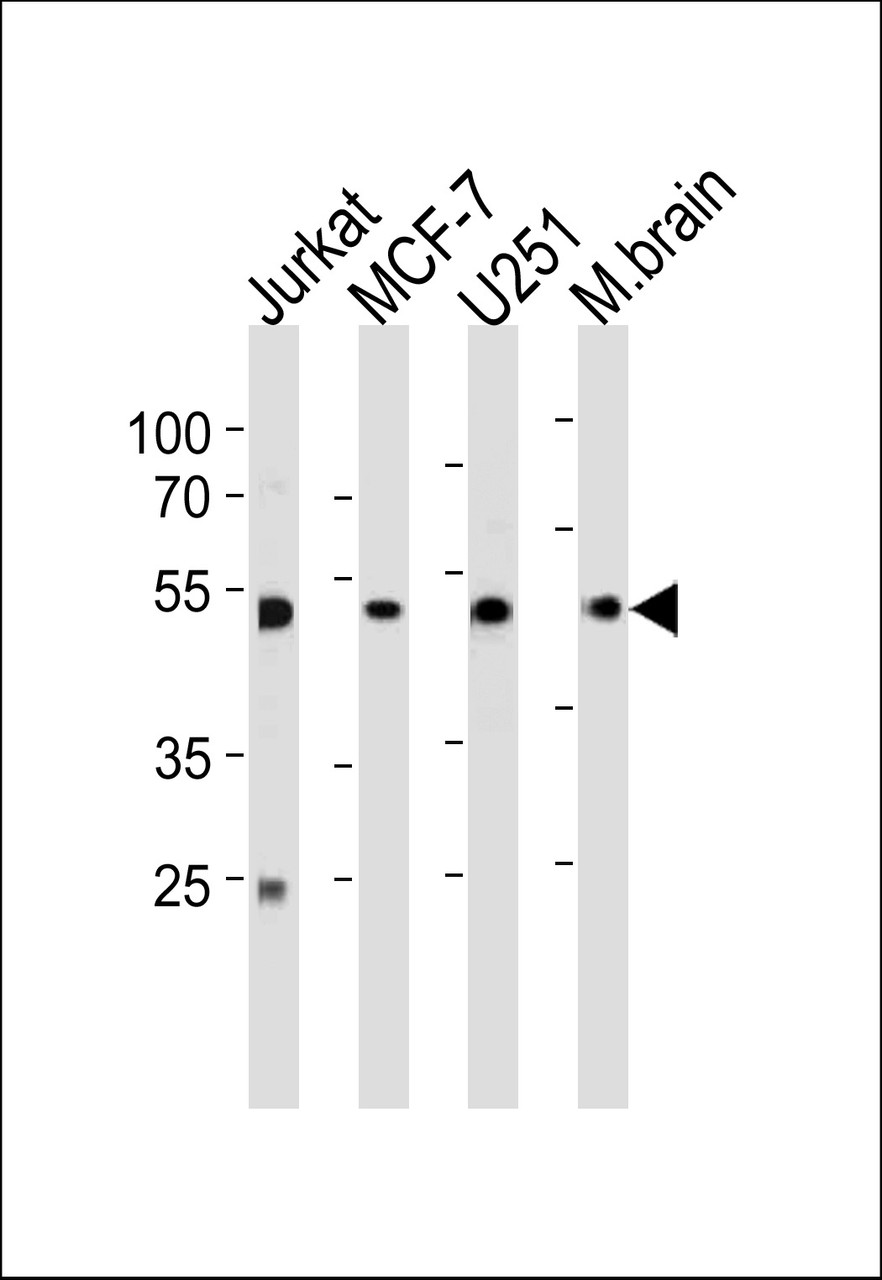 Western blot analysis in Jurkat, MCF-7, U251 cell line and mouse brain tissue lysates (35ug/lane) .
