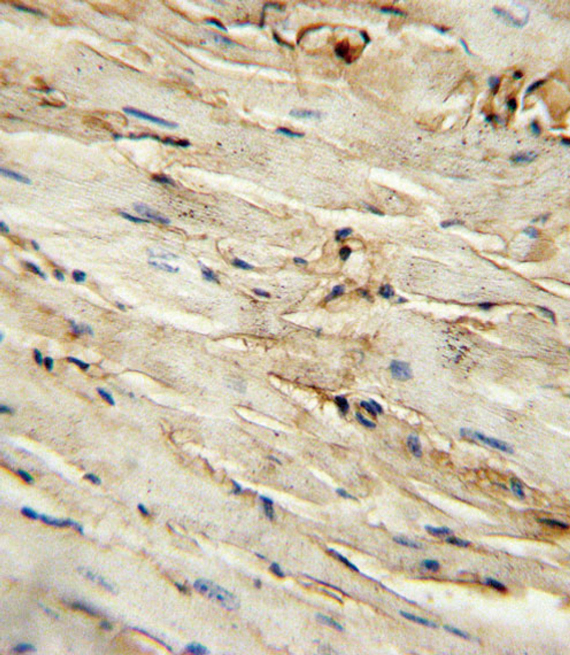 immunohistochemistry analysis in formalin fixed and paraffin embedded mouse heart tissue followed by peroxidase conjugation of the secondary antibody and DAB staining. This data demonstrates the use of the for immunohistochemistry.