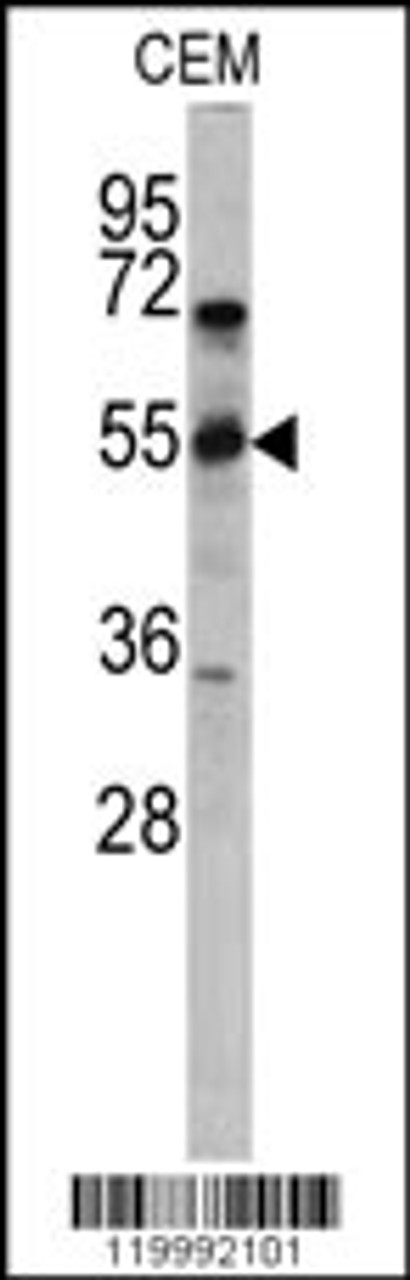 Western blot analysis of CD36 antibody in CEM cell line lysates (35ug/lane)