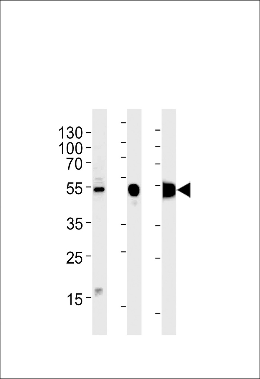 Western blot analysis in RD cell line and mouse skeletal muscle, rat skeletal muscle lysates (35ug/lane) .