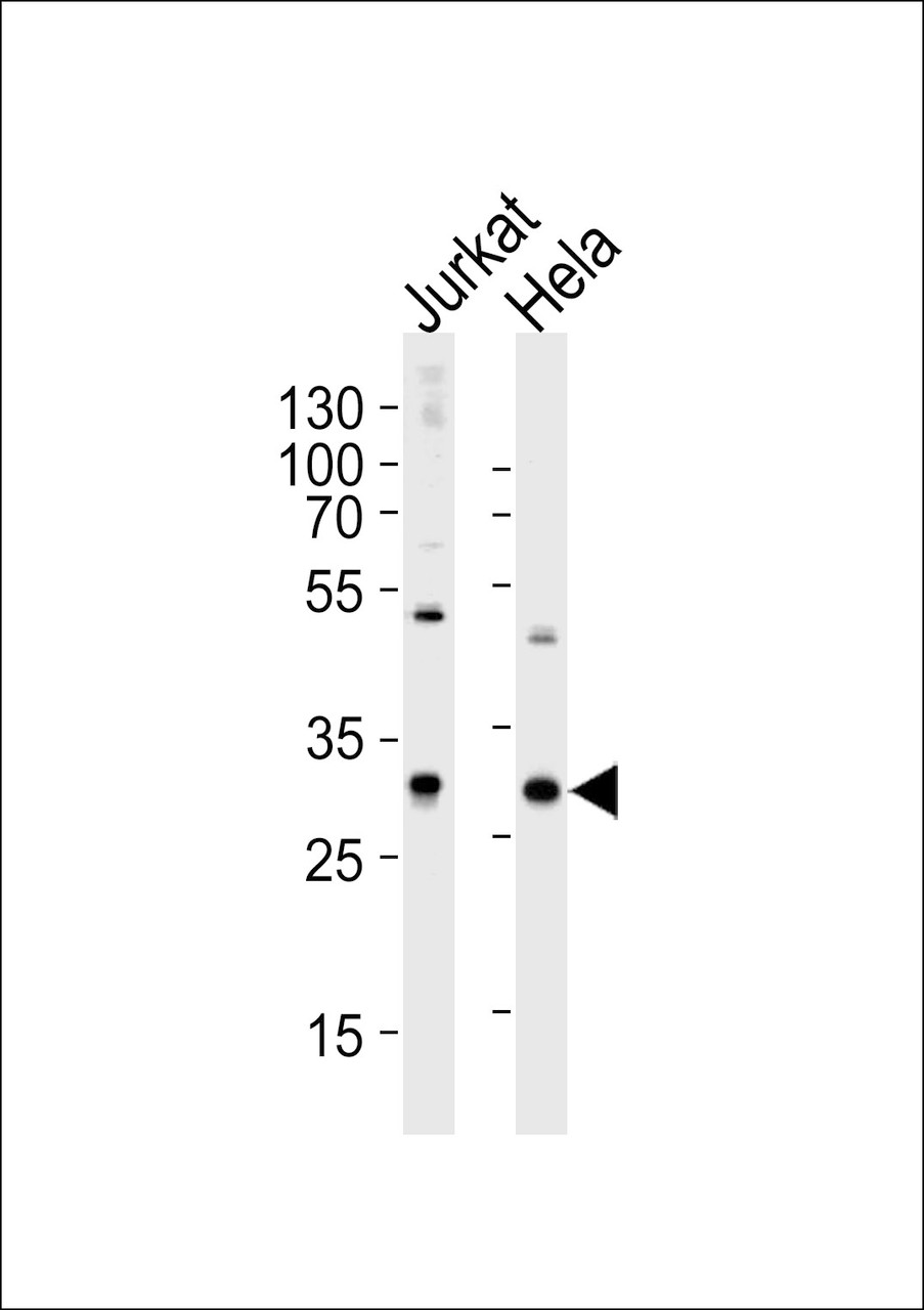 Western blot analysis of lysates from Jurkat, HeLa cell line (from left to right) , using CAPZB Antibody at 1:1000 at each lane.