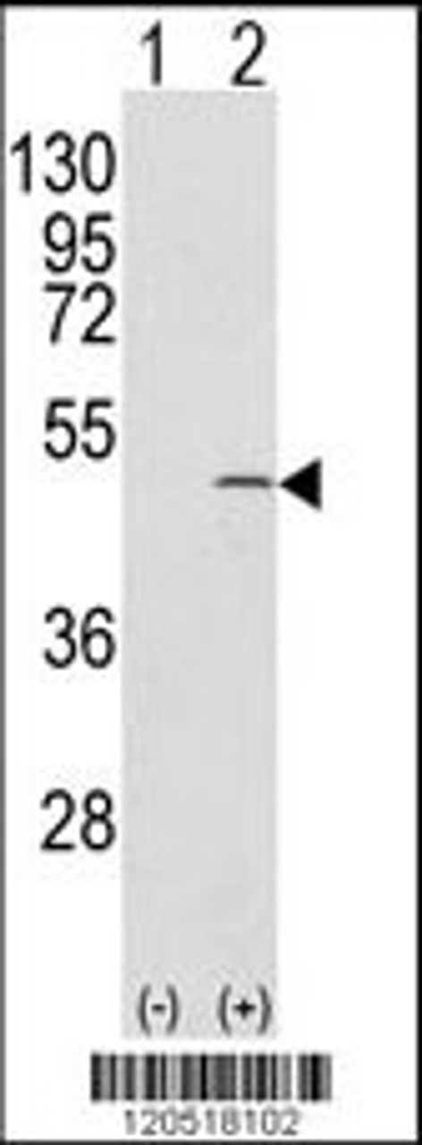 Western blot analysis of CAPZB using rabbit polyclonal CAPZB Antibody using 293 cell lysates (2 ug/lane) either nontransfected (Lane 1) or transiently transfected with the CAPZB gene (Lane 2) .