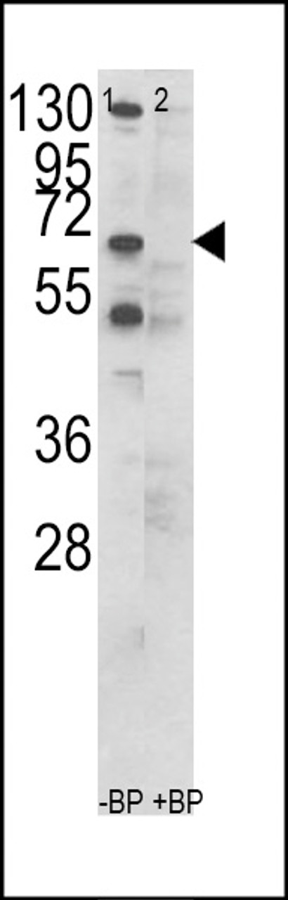 Western blot analysis of CCT3 Antibody in K562 cell line lysates (35ug/lane)