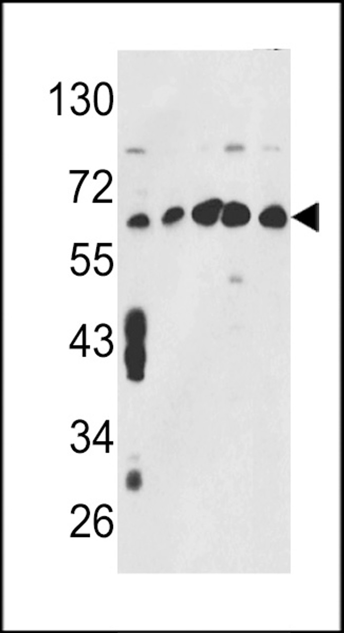 Western blot analysis of CCT3 Antibody in MCF7, CEM, K562, HL-60, Hela cell line lysates (35ug/lane)