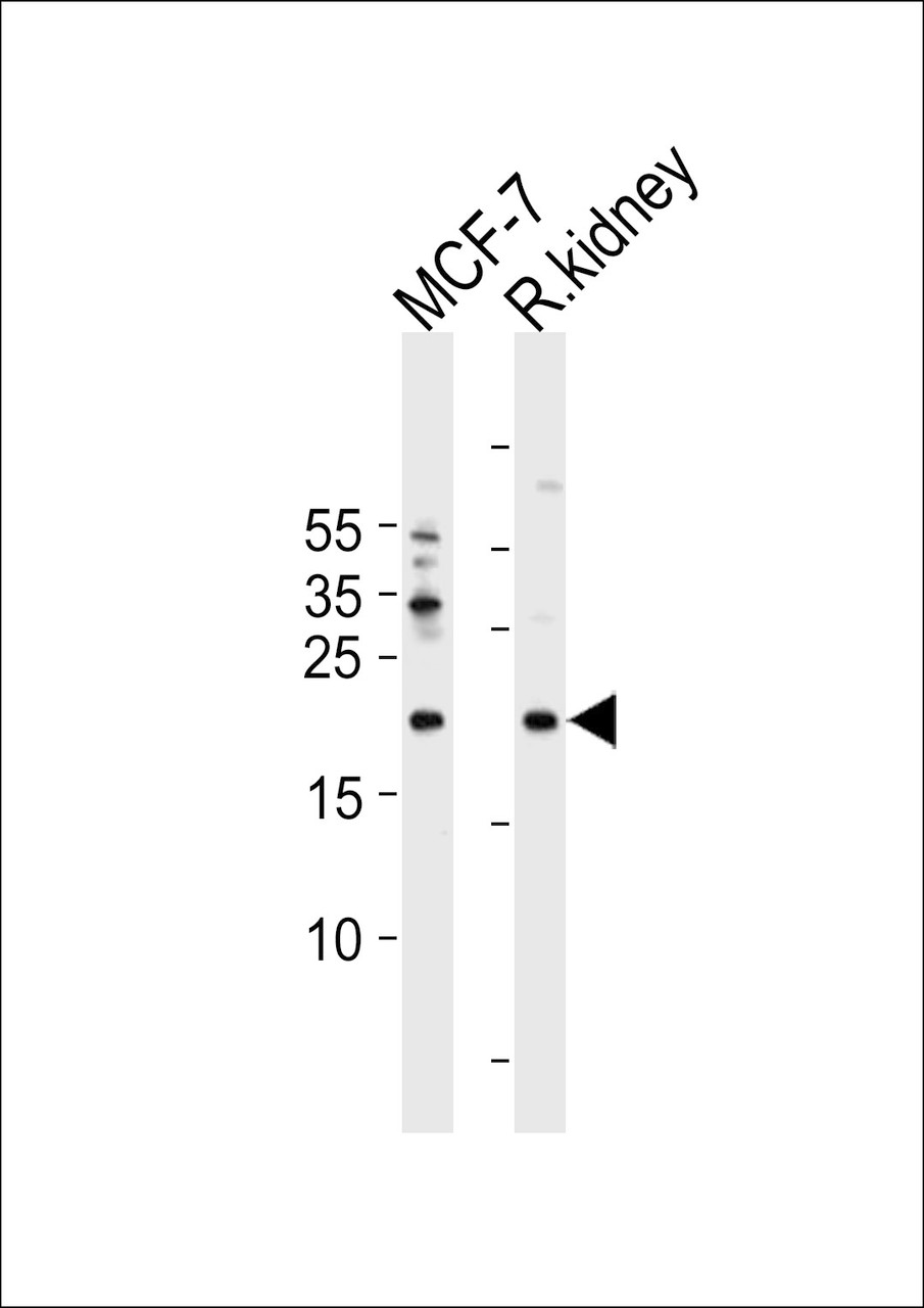 Western blot analysis in MCF-7 cell line and rat kidney tissue lysates (35ug/lane) .