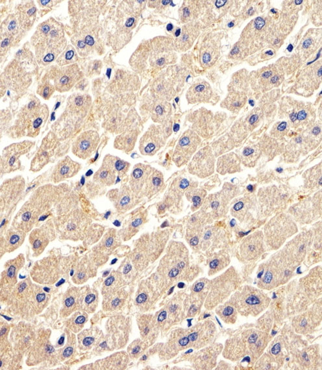 Immunohistochemical analysis of paraffin-embedded H.liver section using ARHGDIA Antibody (N-term) . Antibody was diluted at 1:25 dilution. A peroxidase-conjugated goat anti-rabbit IgG at 1:400 dilution was used as the secondary antibody, followed by DAB staining.