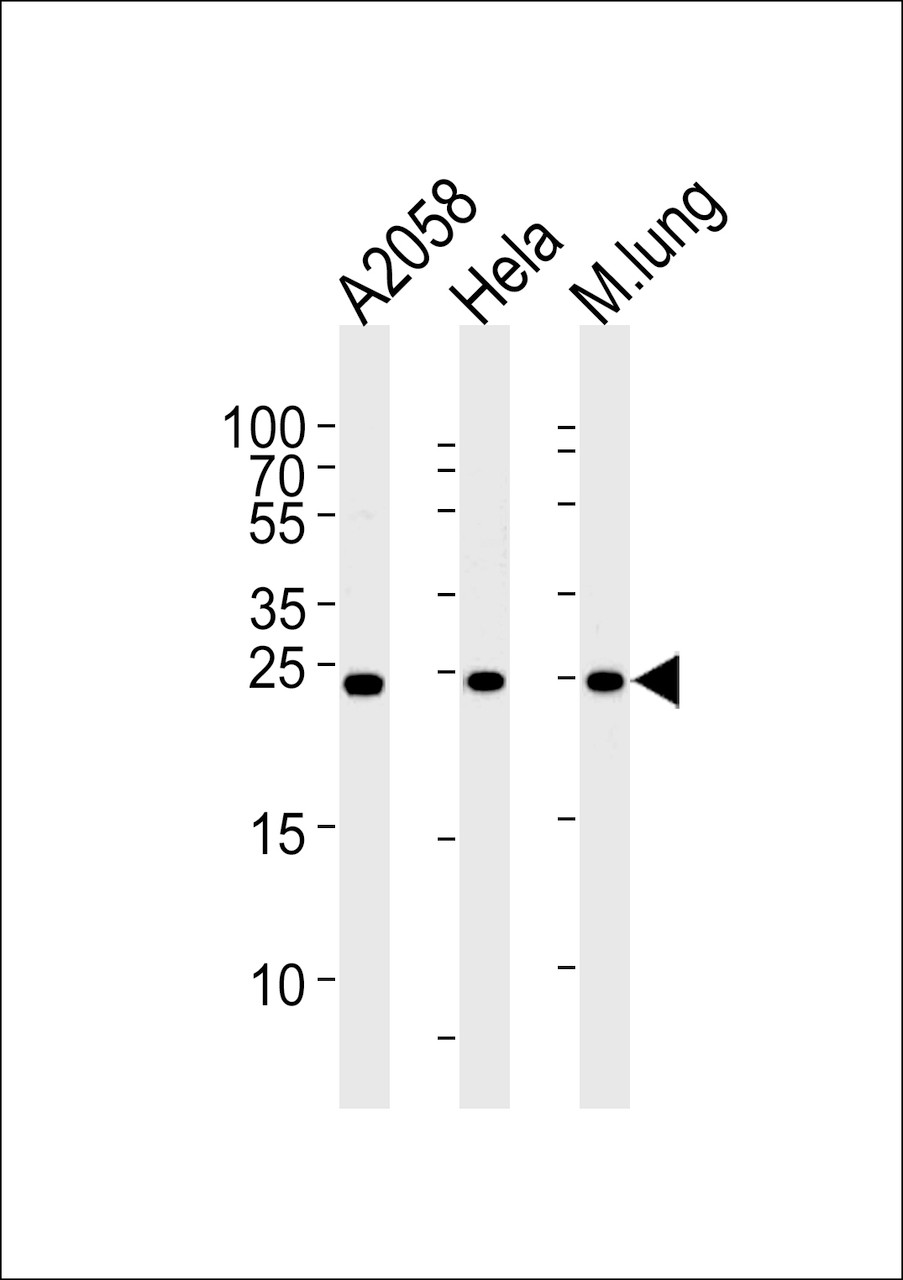 Western blot analysis in A2058, Hela cell line and mouse lung lysates (35ug/lane) .