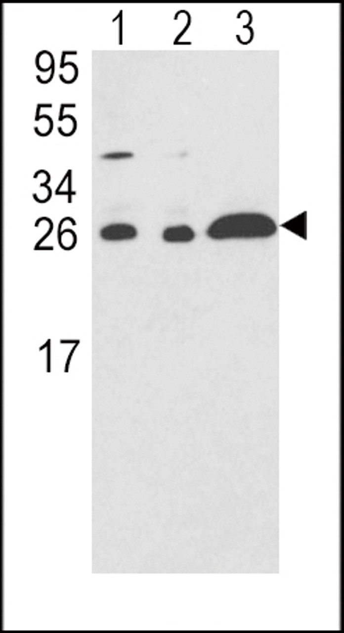 Western blot analysis of ARHGDIA Antibody in A375 (lane 1) , HL-60 (lane 2) , Ramos (lane 3) cell line lysates (35ug/lane)