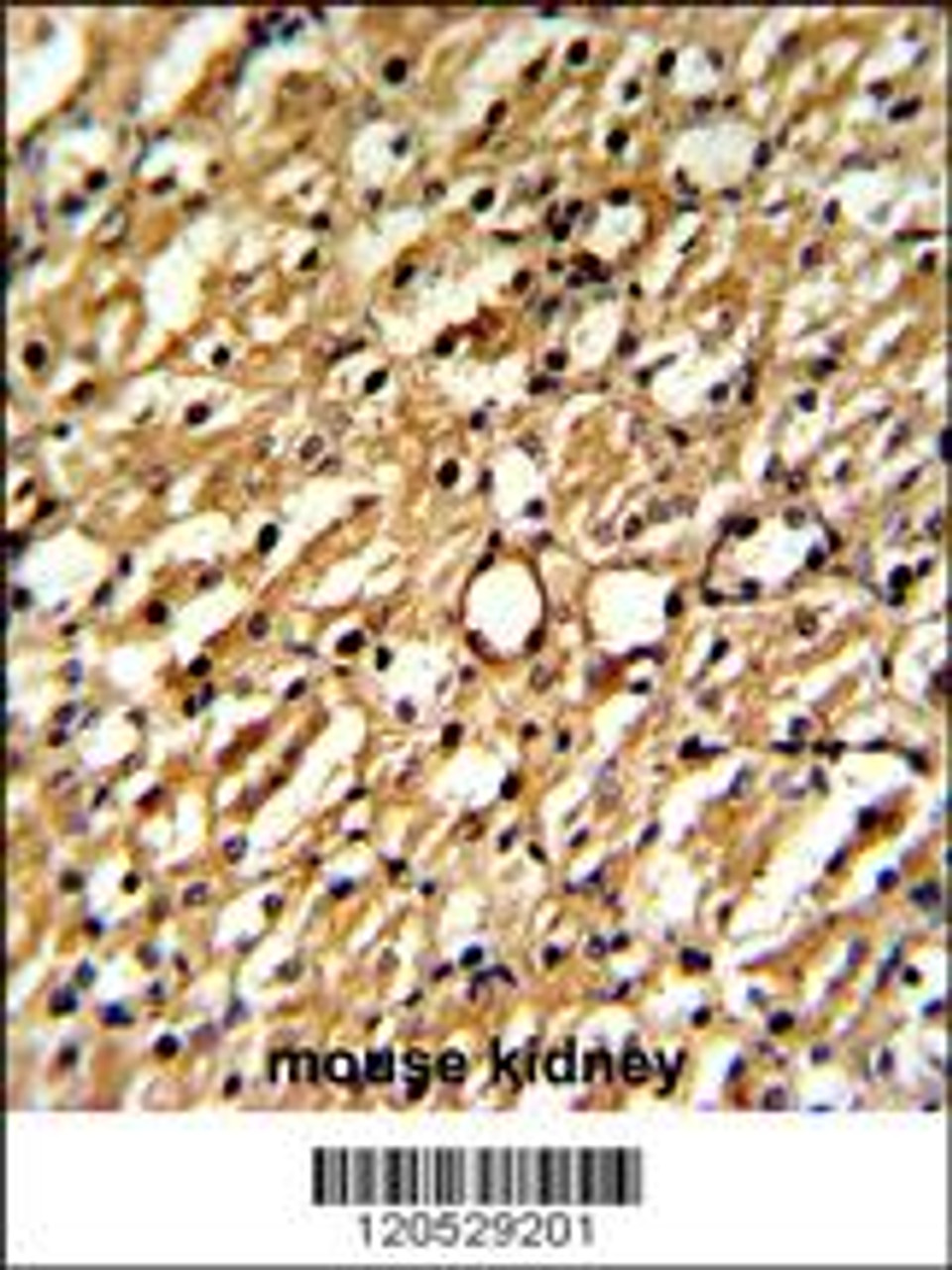 Formalin-fixed and paraffin-embedded mouse kidney reacted with DDAH1 Antibody, which was peroxidase-conjugated to the secondary antibody, followed by DAB staining.