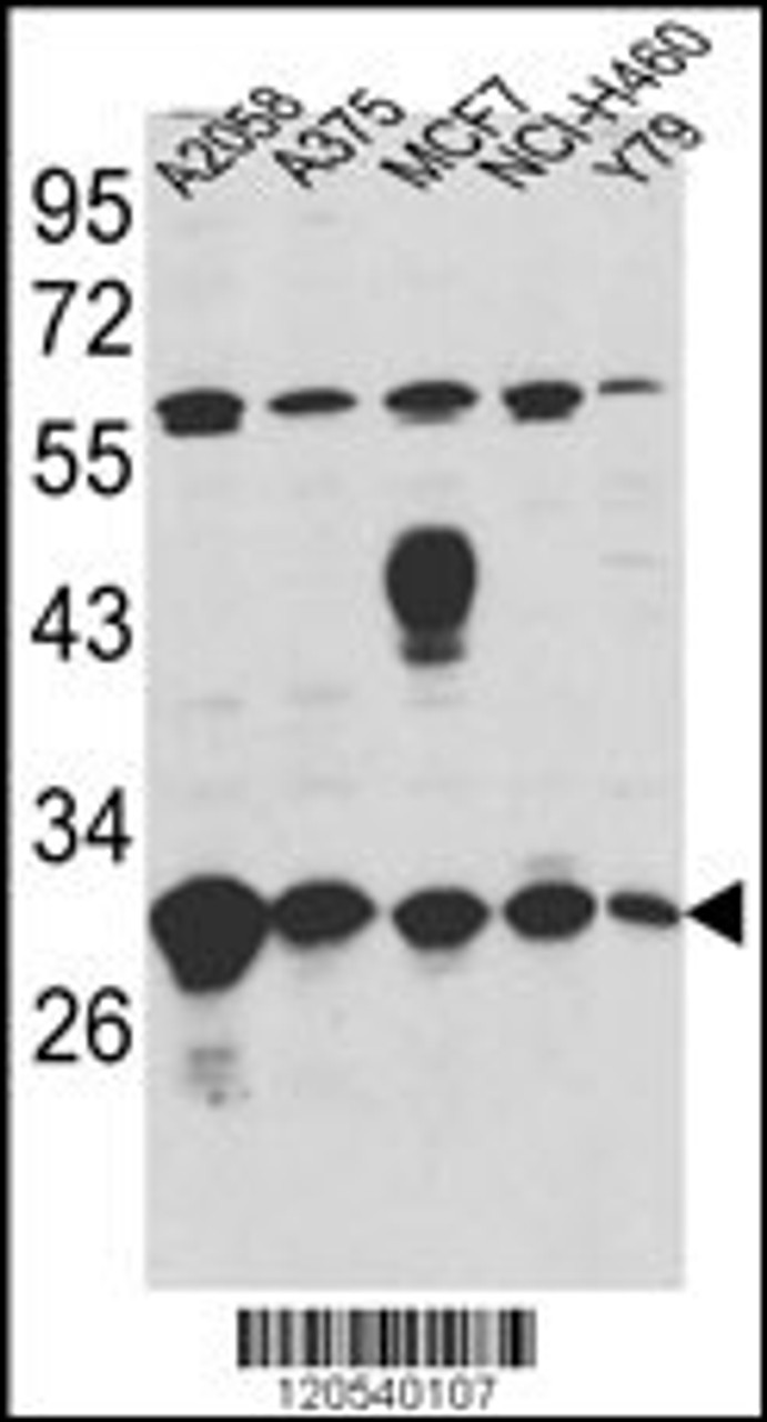 Western blot analysis of ERP29 Antibody in A2058, A375, MCF7, NCI-H460, Y79 cell line lysates (35ug/lane)