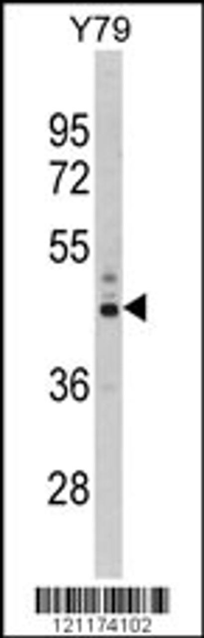 Western blot analysis of PSMD13 Antibody in Y79 cell line lysates (35ug/lane)
