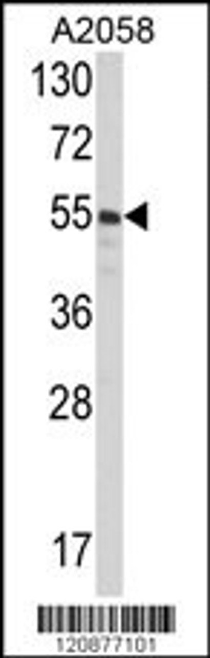 Western blot analysis of PDIA3 Antibody in A2058 cell line lysates (35ug/lane)