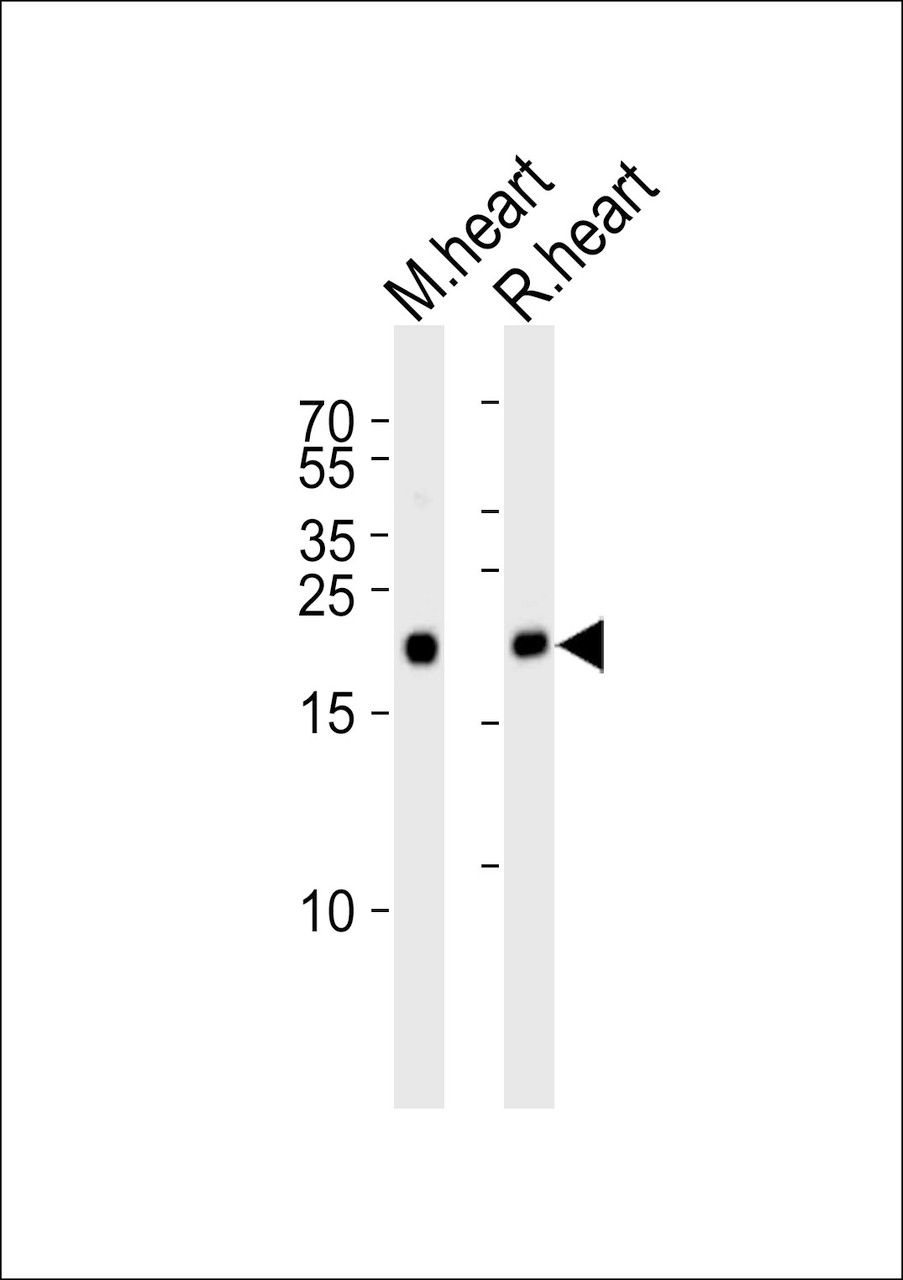 Western blot analysis of lysates from mouse heart and rat heart tissue lysate (from left to right) , using PRDX2 Antibody at 1:1000 at each lane.