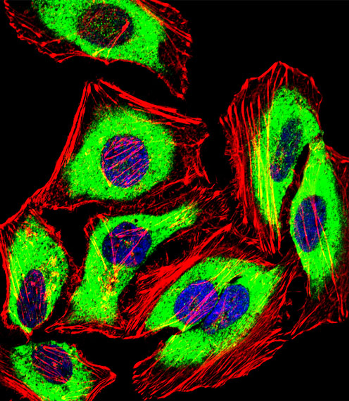 Fluorescent confocal image of Hela cell stained with PRDX2 Antibody .Hela cells were fixed with 4% PFA (20 min) , permeabilized with Triton X-100 (0.1%, 10 min) , then incubated with PRDX2 primary antibody (1:25) . For secondary antibody, Alexa Fluor 488 conjugated donkey anti-rabbit antibody (green) was used (1:400) .Cytoplasmic actin was counterstained with Alexa Fluor 555 (red) conjugated Phalloidin (7units/ml) . Nuclei were counterstained with DAPI (blue) (10 ug/ml, 10 min) .PRDX2 immunoreactivity is localized to Cytoplasm significantly.