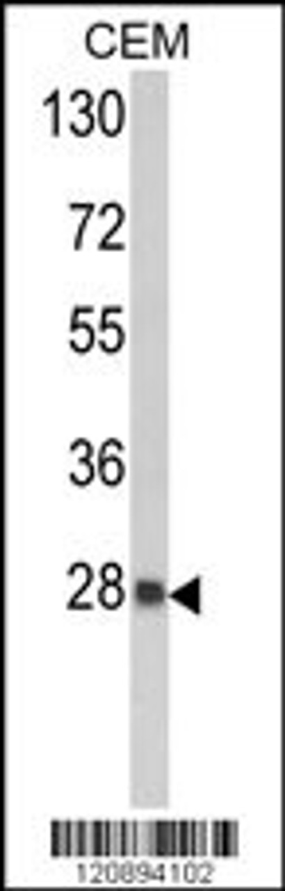 Western blot analysis of PRDX6 Antibody in CEM cell line lysates (35ug/lane)
