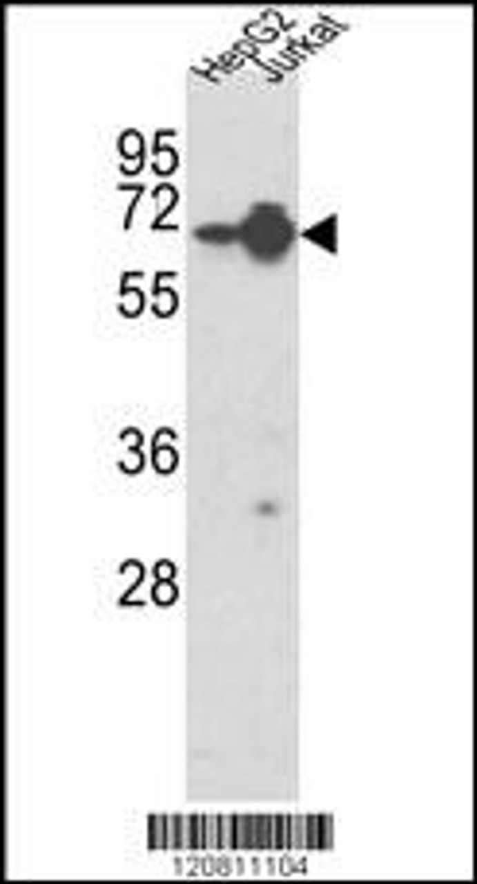 Western blot analysis of HNRPL Antibody in HepG2, Jurkat cell line lysates (35ug/lane)