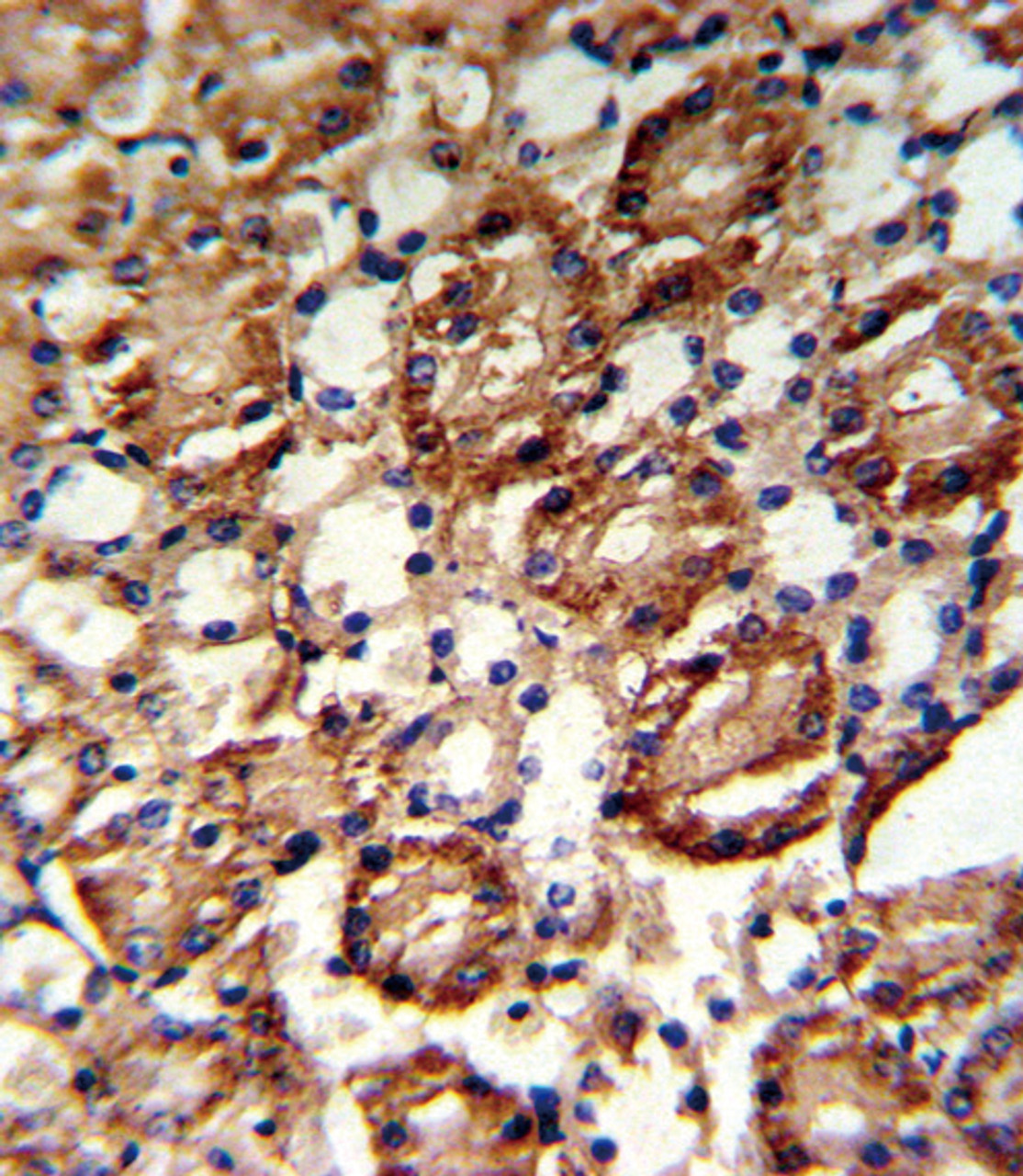 Formalin-fixed and paraffin-embedded kidney tissue reacted with GMPS Antibody, which was peroxidase-conjugated to the secondary antibody, followed by DAB staining.