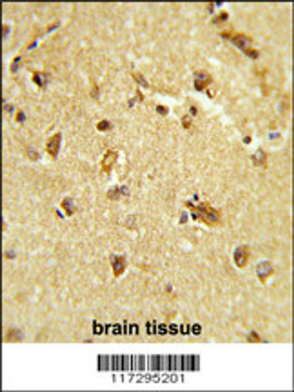 Formalin-fixed and paraffin-embedded brain tissue reacted with RBM14 Antibody, which was peroxidase-conjugated to the secondary antibody, followed by DAB staining.