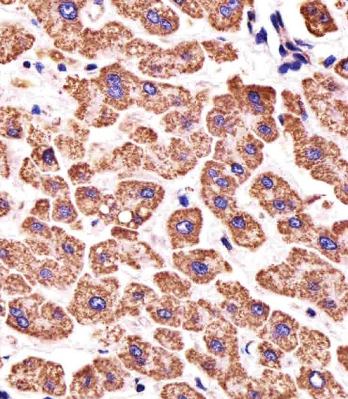 Immunohistochemical analysis of paraffin-embedded H. liver section using ATP5B Antibody . Antibody was diluted at 1:25 dilution. A undiluted biotinylated goat polyvalent antibody was used as the secondary, followed by DAB staining.