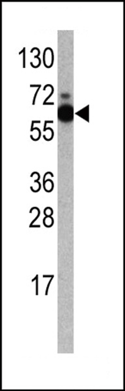 Western blot analysis of anti-RPS6KB1 Antibody Pab in Jurkat cell line lysates (35ug/lane) .