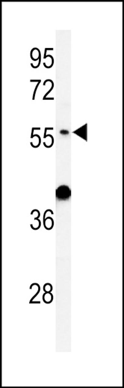 Western blot analysis of ATL3 Antibody in mouse liver tissue lysates (35ug/lane)