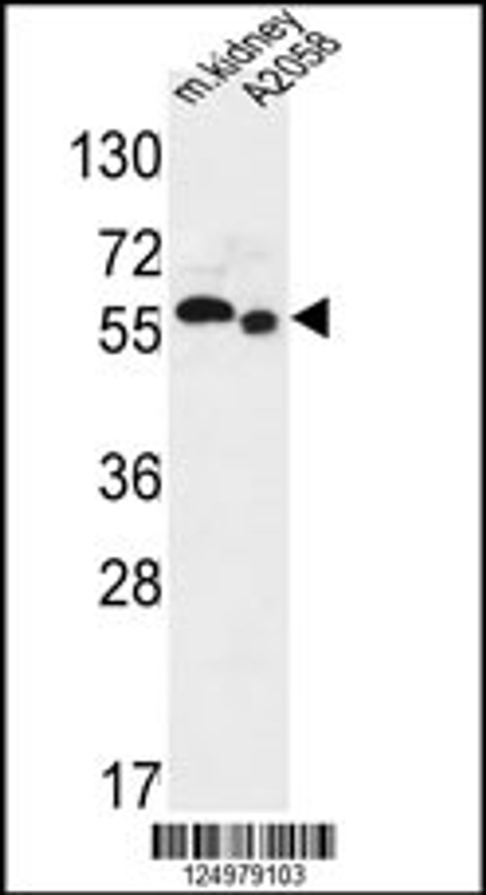 Western blot analysis in mouse kidney tissue and A2058 cell line lysates (35ug/lane) .