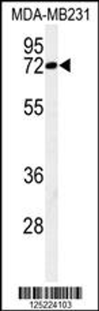 Western blot analysis of CJ119 Antibody in MDA-MB231 cell line lysates (35ug/lane)