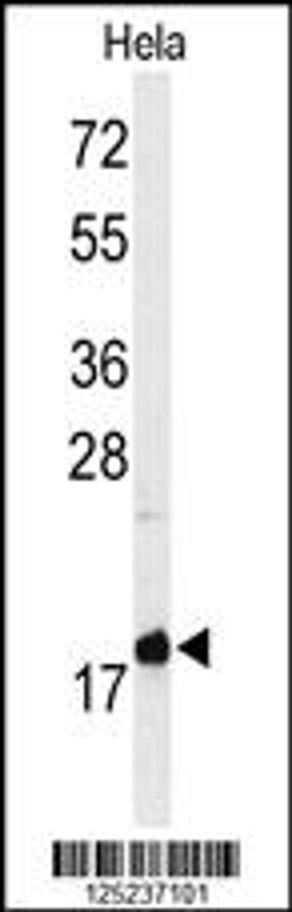 Western blot analysis of MMGT1 Antibody in Hela cell line lysates (35ug/lane)