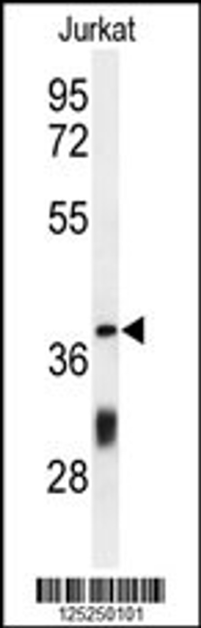 Western blot analysis of CC130 Antibody in Jurkat cell line lysates (35ug/lane)