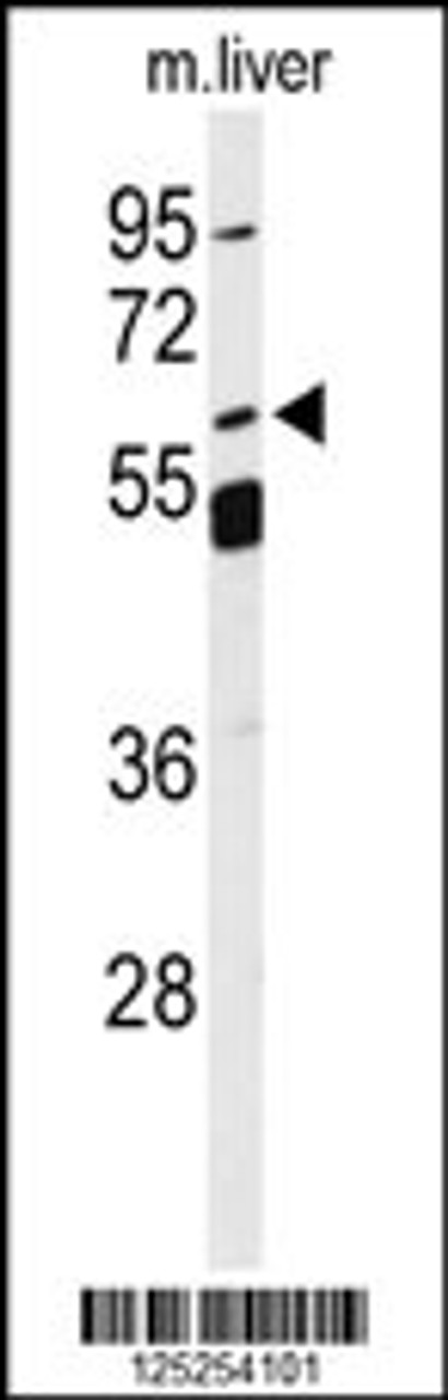 Western blot analysis of S13A5 Antibody in mouse liver tissue lysates (35ug/lane)