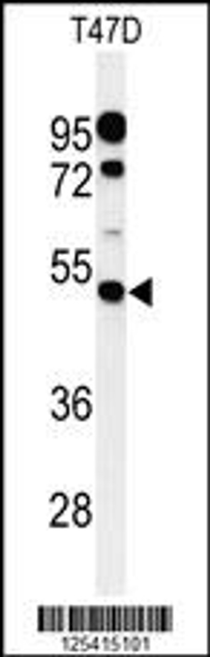 Western blot analysis of PIGM Antibody in T47D cell line lysates (35ug/lane)