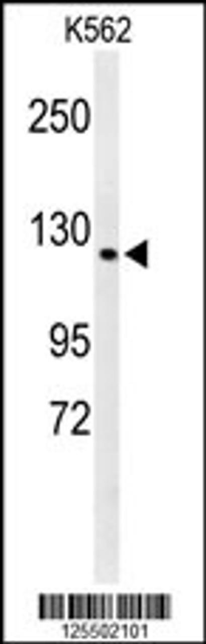 Western blot analysis of CQ068 Antibody in K562 cell line lysates (35ug/lane)