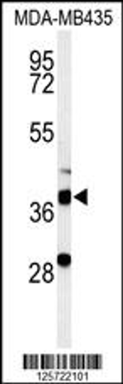 Western blot analysis of DHRS7 Antibody in MDA-MB435 cell line lysates (35ug/lane)