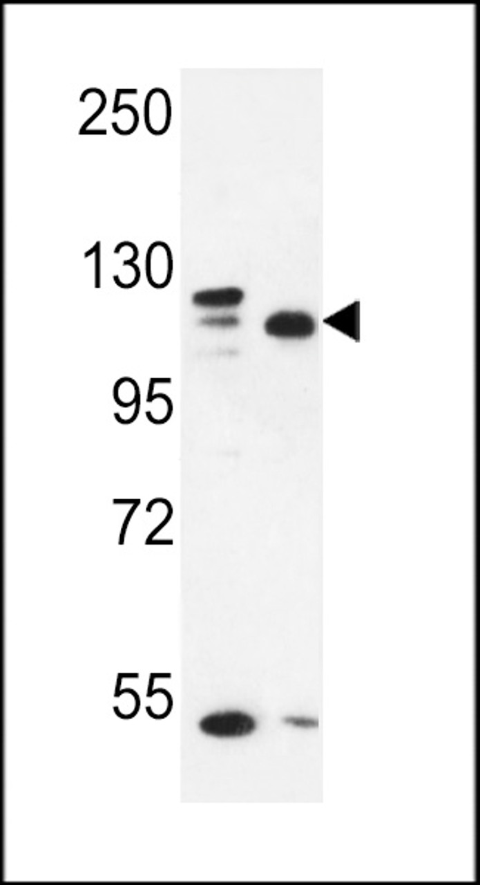 Western blot analysis in MDA-MB435, MCF-7 cell line lysates (35ug/lane) .