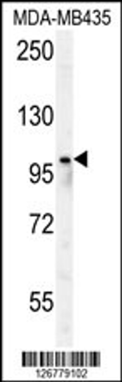 Western blot analysis in MDA-MB435 cell line lysates (35ug/lane) .