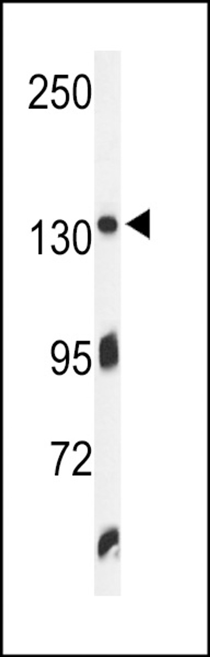 Western blot analysis of ZO1 Antibody in K562 cell line lysates (35ug/lane)