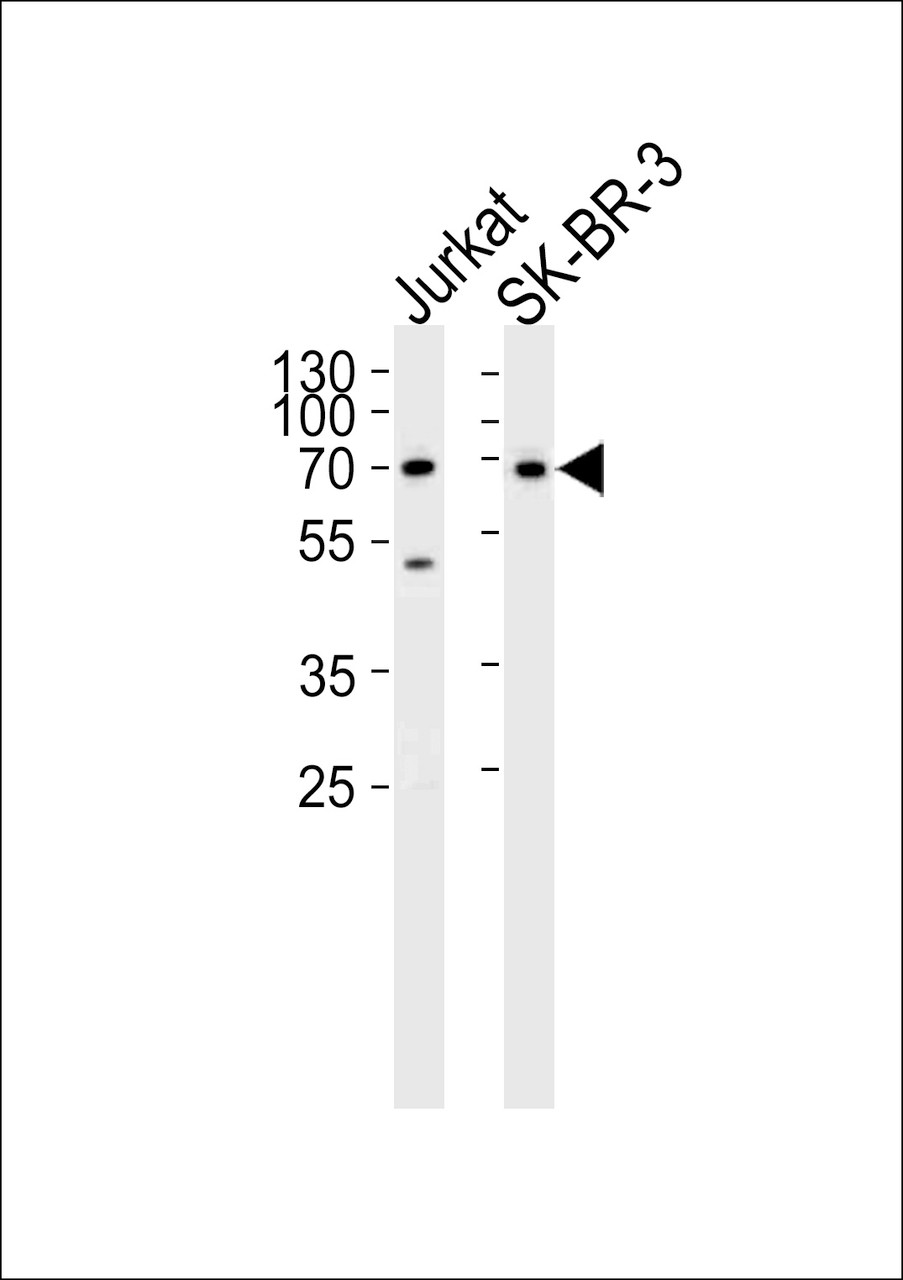 Western blot analysis of lysates from Jurkat, SK-BR-3 cell line (from left to right) , using CD46 Antibody .AP4785b was diluted at 1:1000 at each lane.