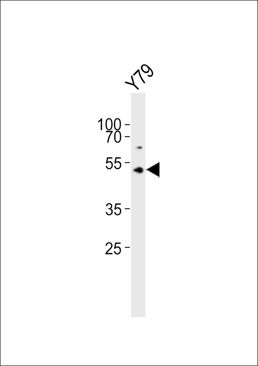 Western blot analysis of lysate from Y79 cell line, using ASMT Antibody at 1:1000.